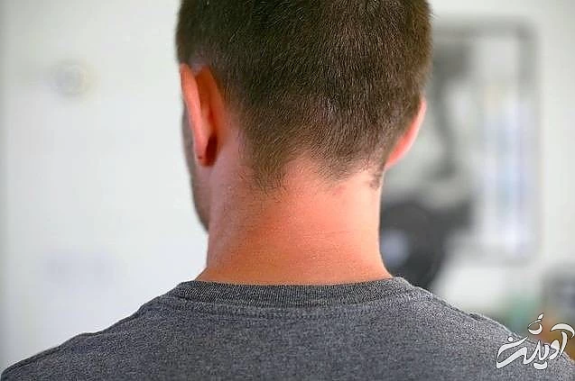 درآمد عجیب مرد روسی از گردنش درآمد از گردن